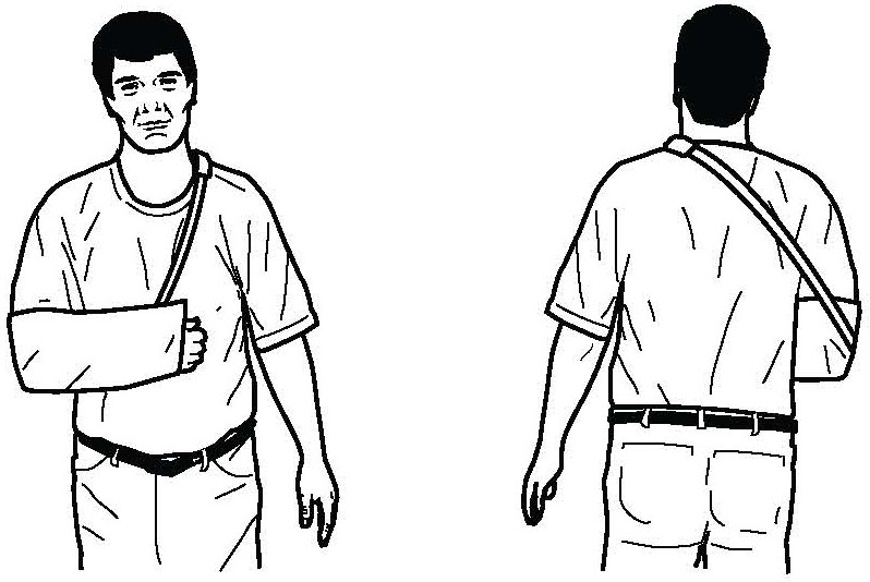 WearingShoulderSling2